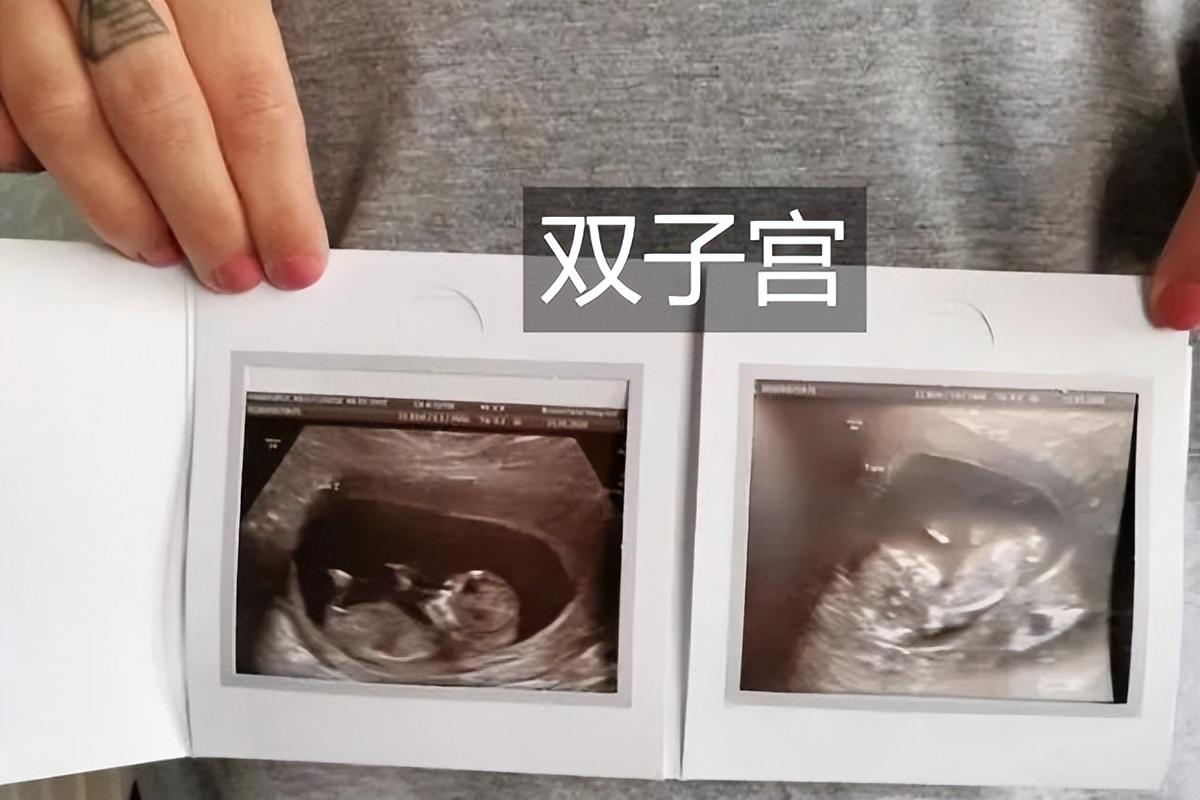 澳门码免费资料，详细解答、精准解答解释落实