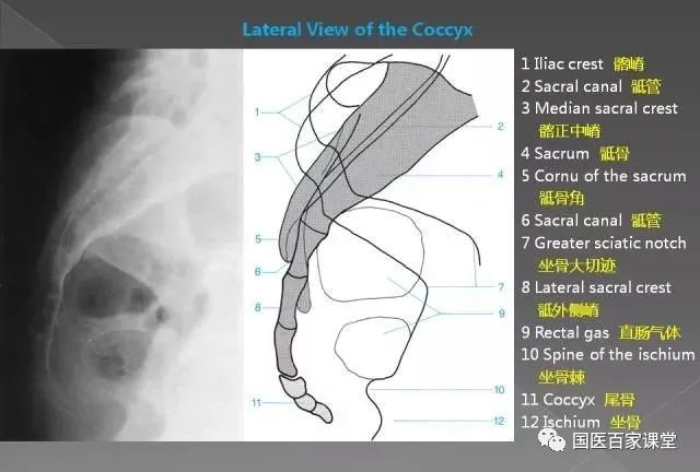 腰间盘突出怎样治详细解答、解释与落实、实证解答解释落实